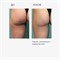 LAMAR - скраб для тела антицеллюлитный COFFEE LIPOSUCTION, 500 г 011-080 - фото 2344