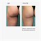 LAMAR - гель антицеллюлитный CELLULITE CONTROL 10 IN 1, 250 мл 011-083 - фото 2380